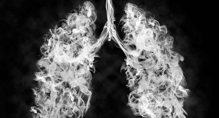 Lung Cancer Risks Myths vs. Facts