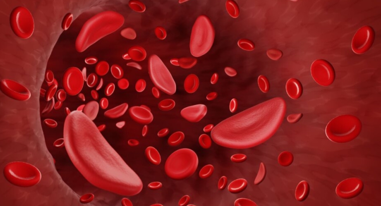 Sickle Cell Awareness: Important Facts To Know About The Disease