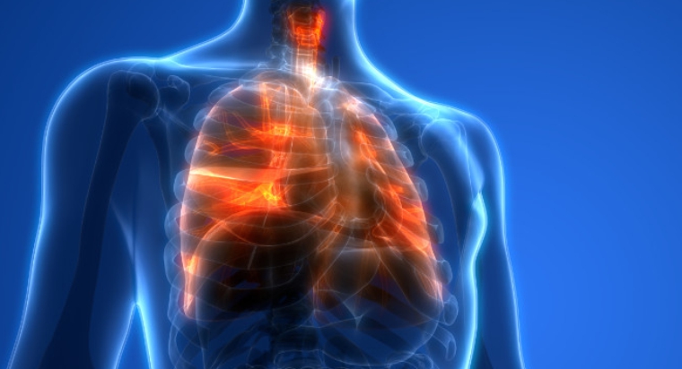 pulmonary hypertension